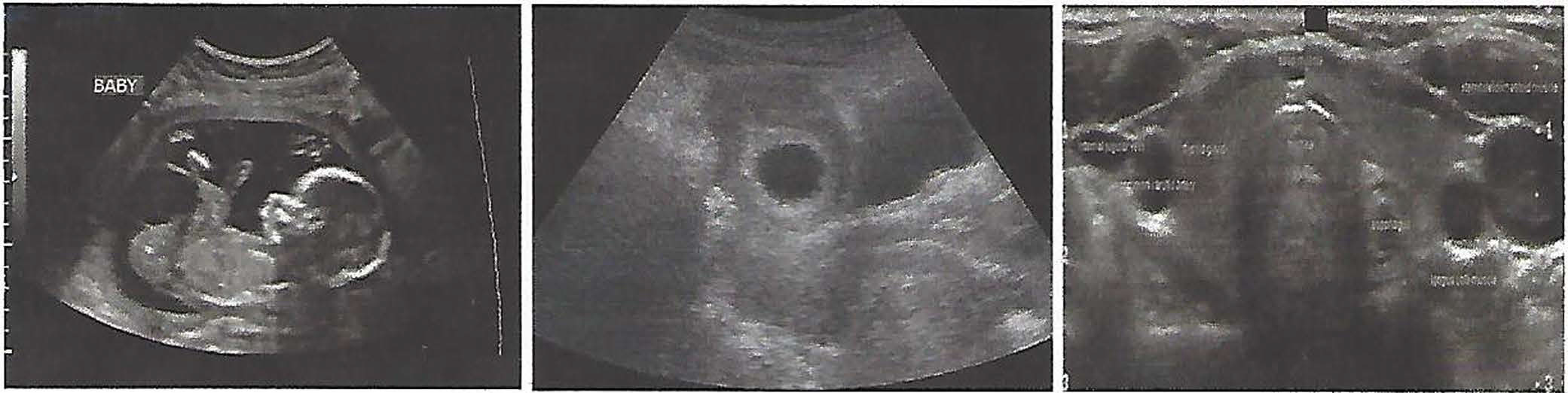 A Picture of a general ultrasound