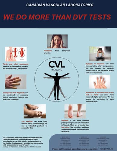 We do more than DVT tests